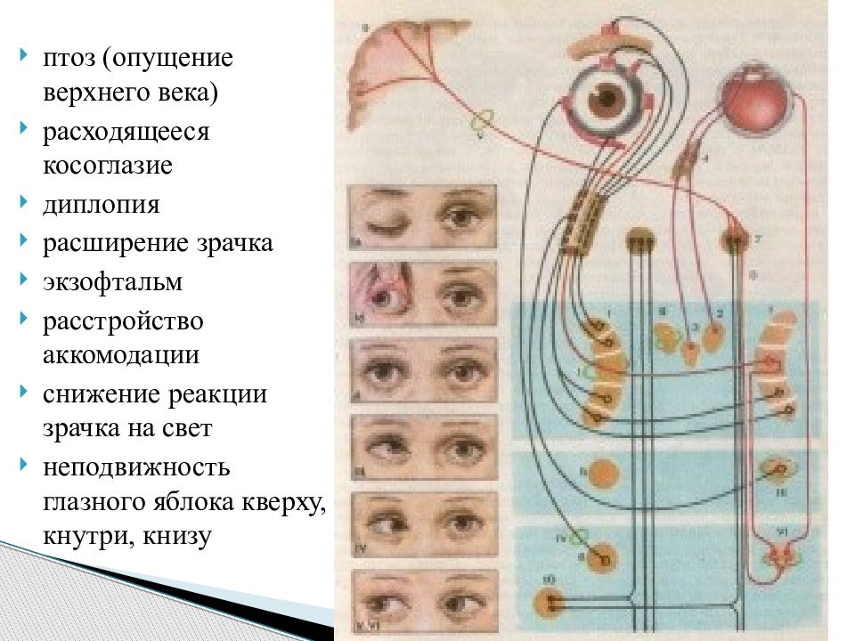 Птоз нерв. Птоз с расширением зрачка. Птоз наблюдается при поражении пары черепных нервов:. 3 Пара черепных нервов и птоз века.