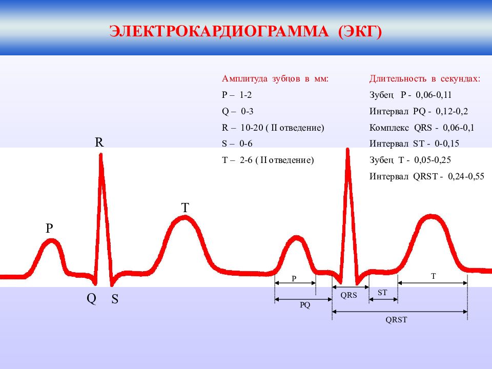 Р q s. Амплитуды зубцов ЭКГ В норме. Амплитуда ЭКГ QRST. Нормы зубцов и интервалов ЭКГ. Интервал q-t ЭКГ (QRST).