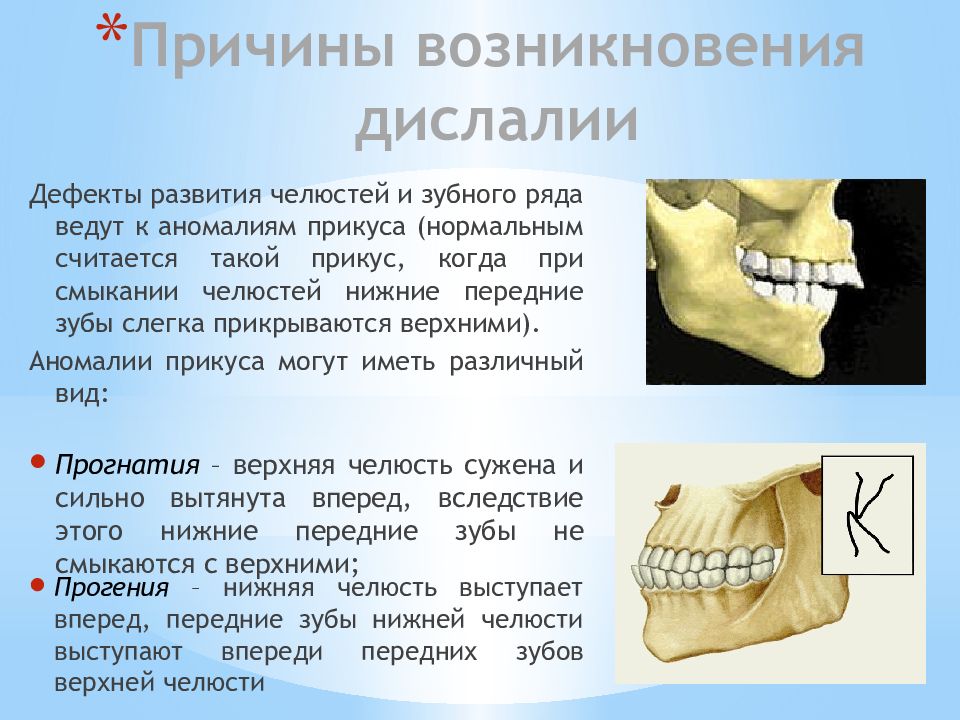 Артикуляционная дислалия. Дислалия это простыми словами. Полиморфная функциональная дислалия. Дефекты механической дислалии. Механическая дислалия примеры.