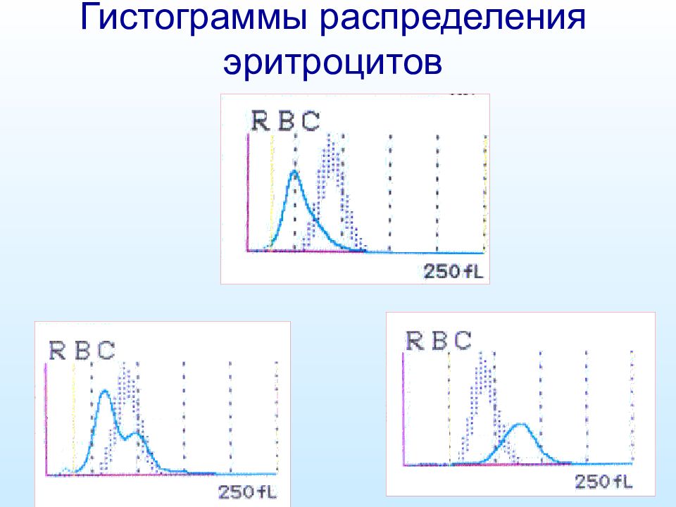 Распределение эритроцитов. Гистограмма распределения гематологический анализатор. Гистограмма распределения лейкоцитов. Гистограмма объема эритроцитов. Гистограмма распределения эритроцитов.