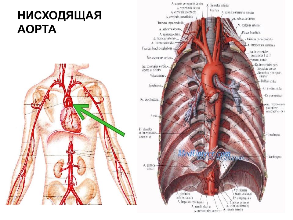 Что такое аорта. Нисходящая аорта. Нисходящий отдел аорты. Части нисходящей аорты.