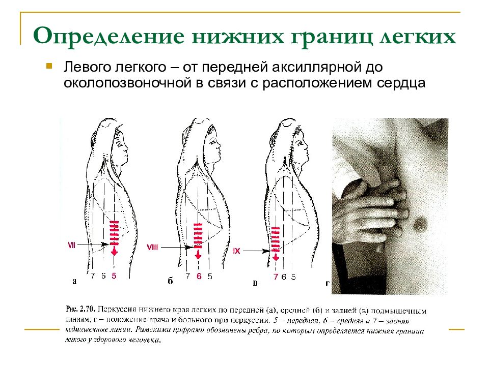 Перкуссия легких сравнительная и топографическая