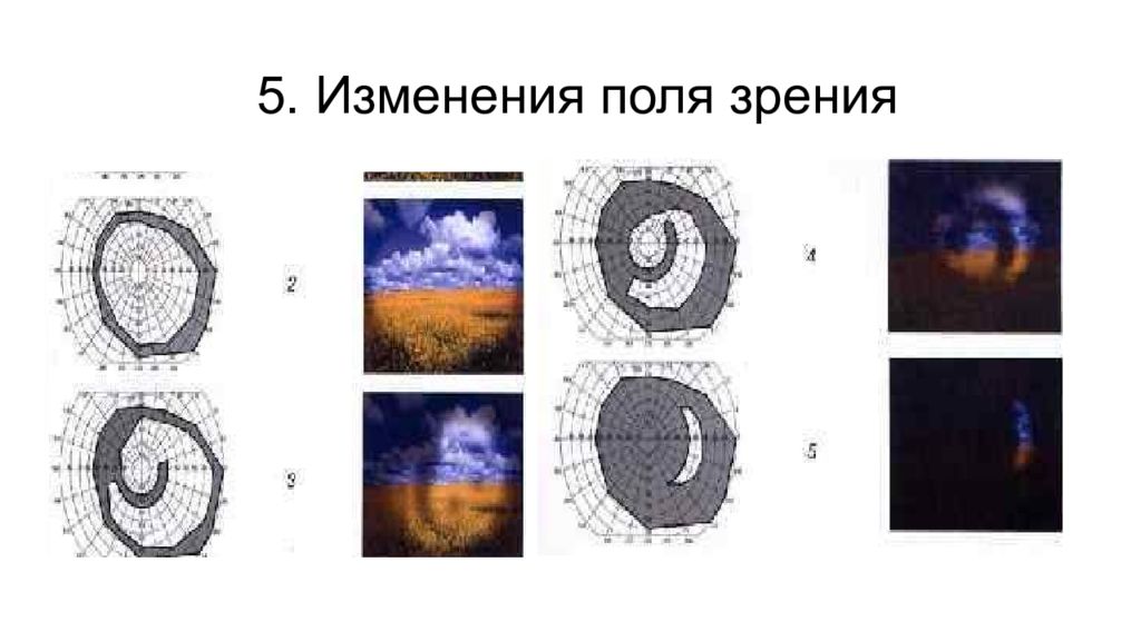 Периферическое зрение картинки