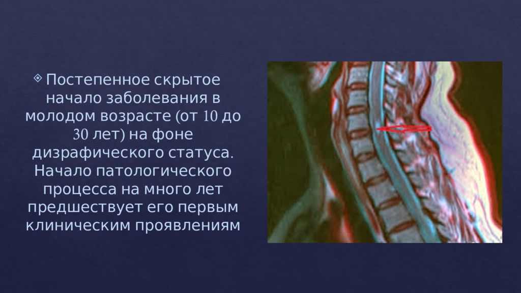 Начинать скрытый. Дизрафический статус сирингомиелия. Сирингомиелия презентация. Сирингомиелия шейного и грудного отделов позвоночника.