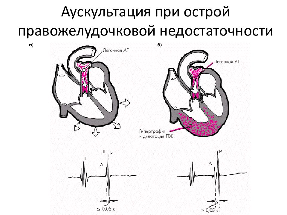 Недостаточность кровообращения презентация