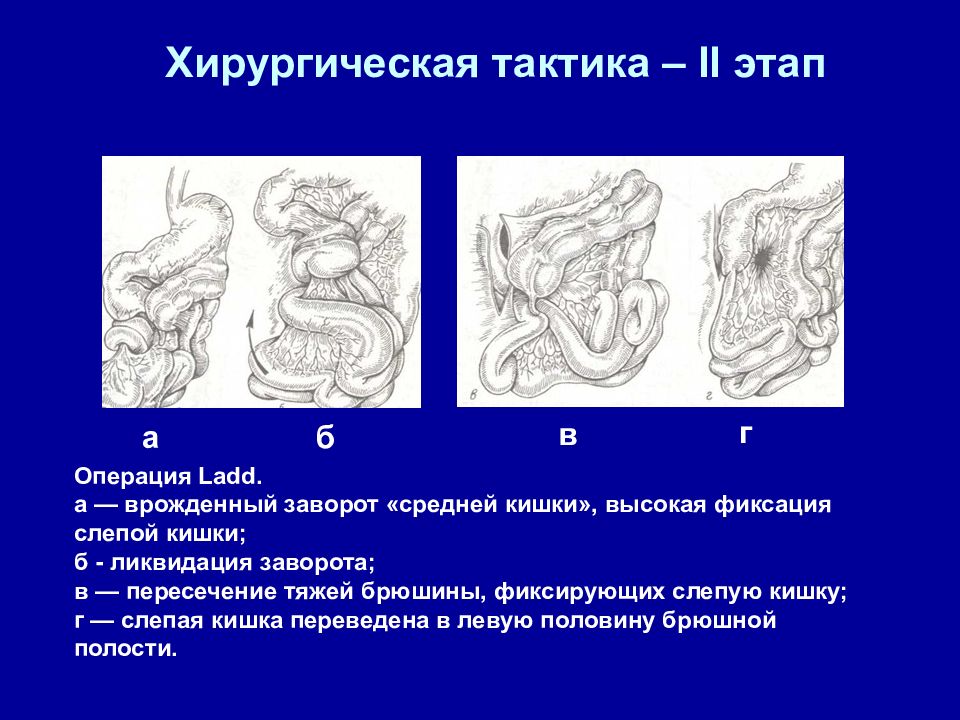 Врожденная низкая кишечная непроходимость презентация