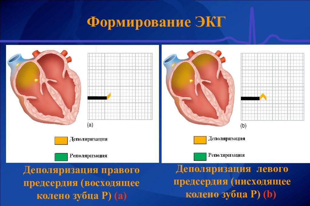 Деполяризация миокарда на экг. Реполяризация миокарда желудочков экг. Деполяризация и реполяризация миокарда. Процесс реполяризации желудочков. Деполяризация это в экг.