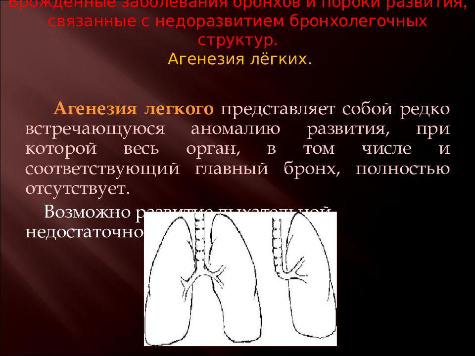 Агенезия это. Аномалии развития легкого. Пороки развития бронхолегочной системы. Пороки развития бронхолегочной системы у детей.