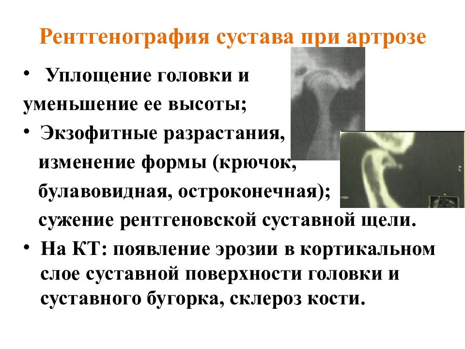 Презентация заболевания внчс