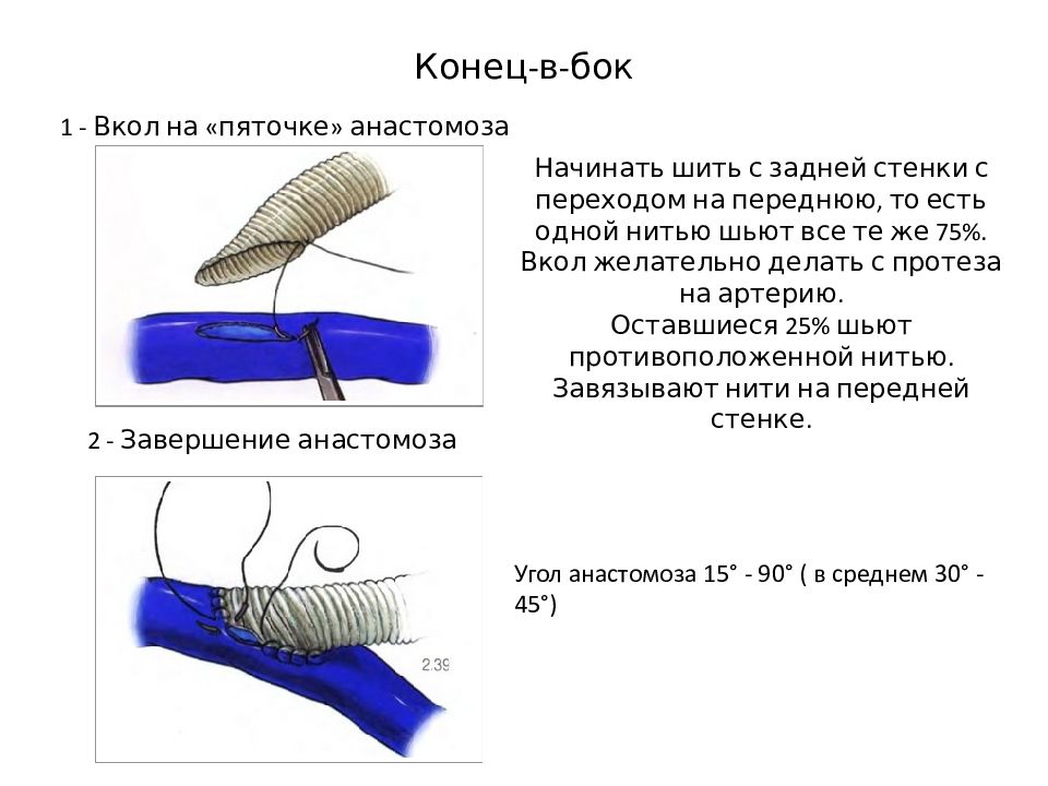 Оперативная хирургия нижней конечности презентация