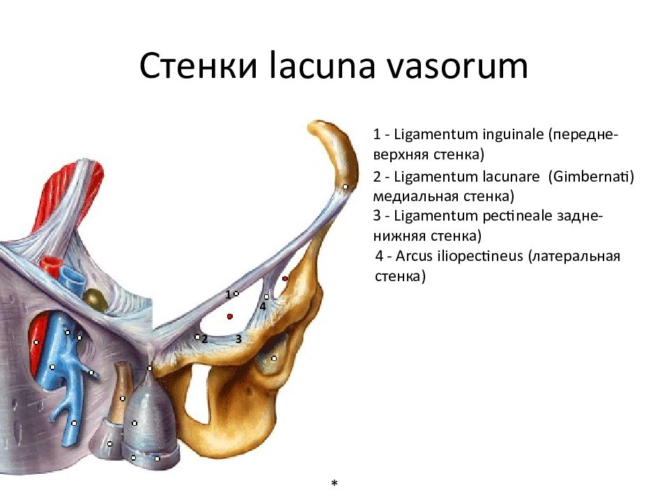 Стенка на латыни. Canalis femoralis стенки. Лимфатический узел Пирогова-Розенмюллера. Anulus femoralis стенки. Бедренный канал, Canalis femoralis.