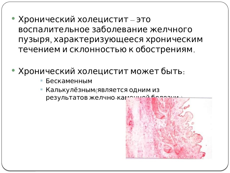 Презентация на тему хронический холецистит