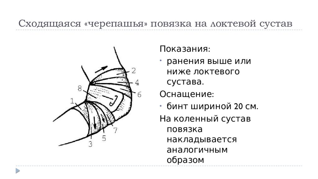 Наложение черепашьей повязки на коленный сустав. Черепашья повязка на колено сходящаяся. Черепашья повязка на локтевой сустав. Сходящая черепашья повязка на коленный сустав. Черепашья сходящаяся повязка на коленный сустав алгоритм.