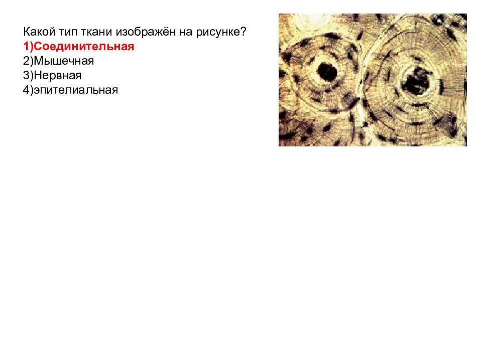 Какая ткань изображена на рисунке эпителиальная мышечная соединительная нервная