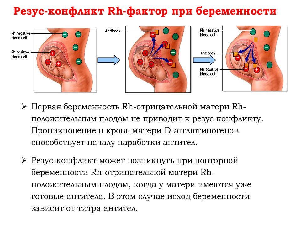 Хелез