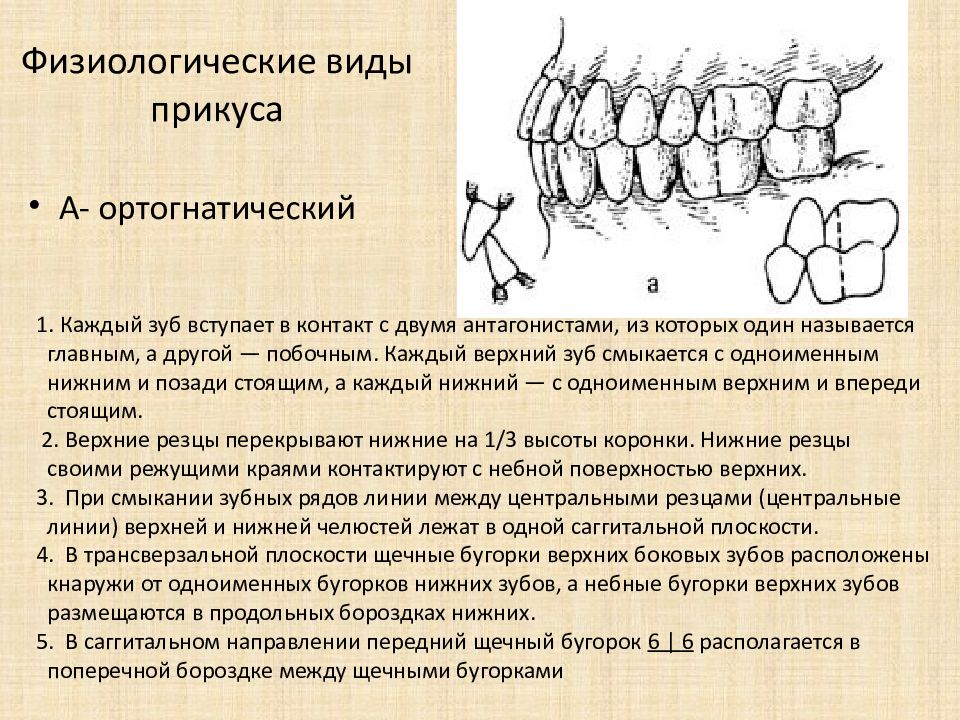 Типы окклюзии