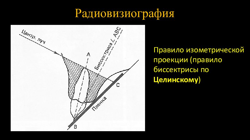 Правило проекции. Контактная рентгенография по правилу изометрии. Рентгенография периапикальных тканей в изометрической проекции. Внутриротовая контактная рентгенография по правилу изометрии.