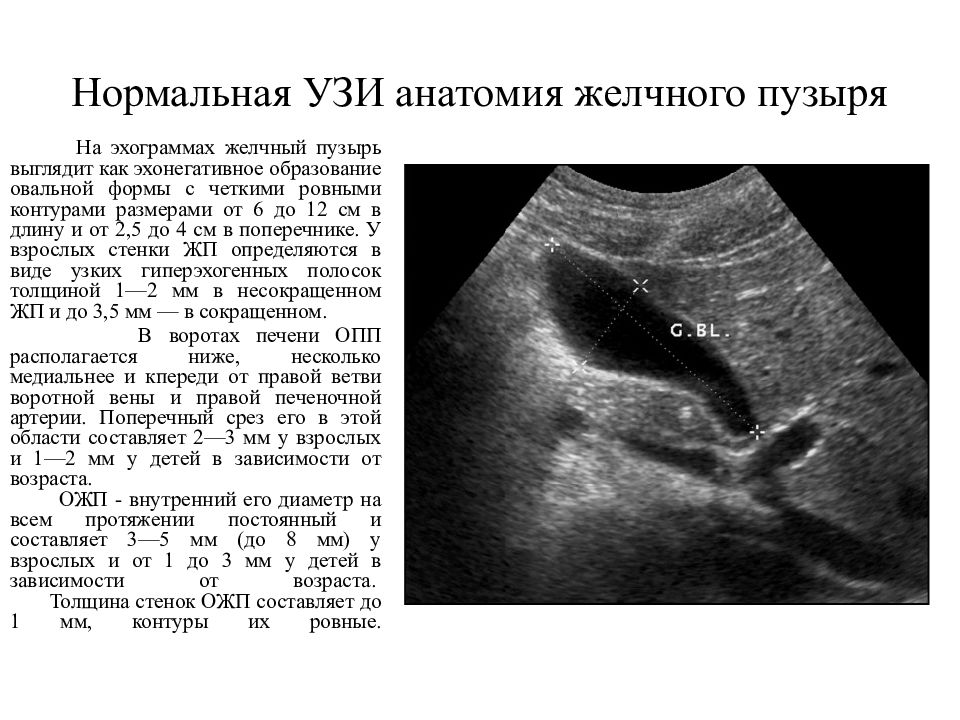 Узи желчного. УЗИ анатомия желчного пузыря. Методика УЗИ желчного пузыря. УЗИ желчного пузыря нормальные показатели. Анатомия мочевого пузыря на УЗИ.