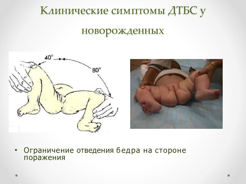 Клинические симптомы ДТБС у новорожденных