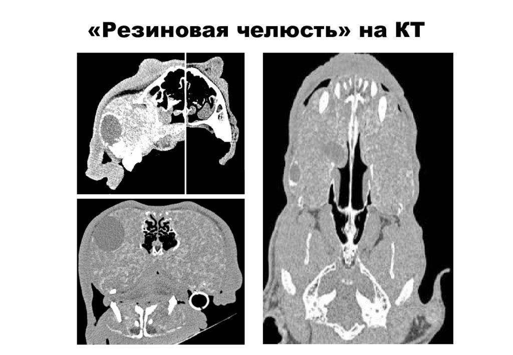 Кт лицевых костей. Кт компьютерная томография черепа. Компьютерная томография лицевого отдела черепа. Компьютерная томограмма лицевого отдела черепа. Кт лицевого отдела черепа.