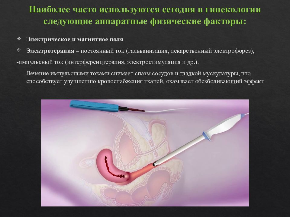 Физиотерапия в гинекологии как проводится в картинках