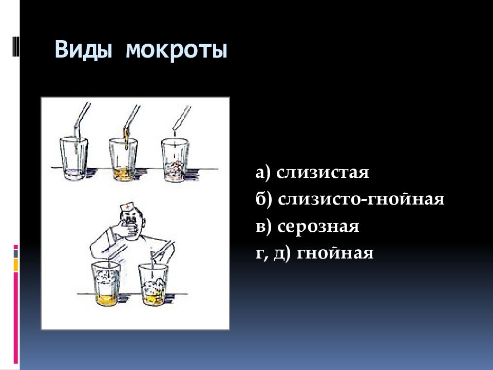 Виды мокроты. Виды мокроты схема. Виды внешнего вида мокроты. Виды мокроты слизисто гнойные.