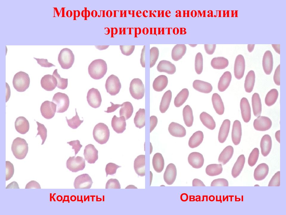 Диагностическое значение визуальной эндоскопической картины при заболеваниях желудка и кишечника