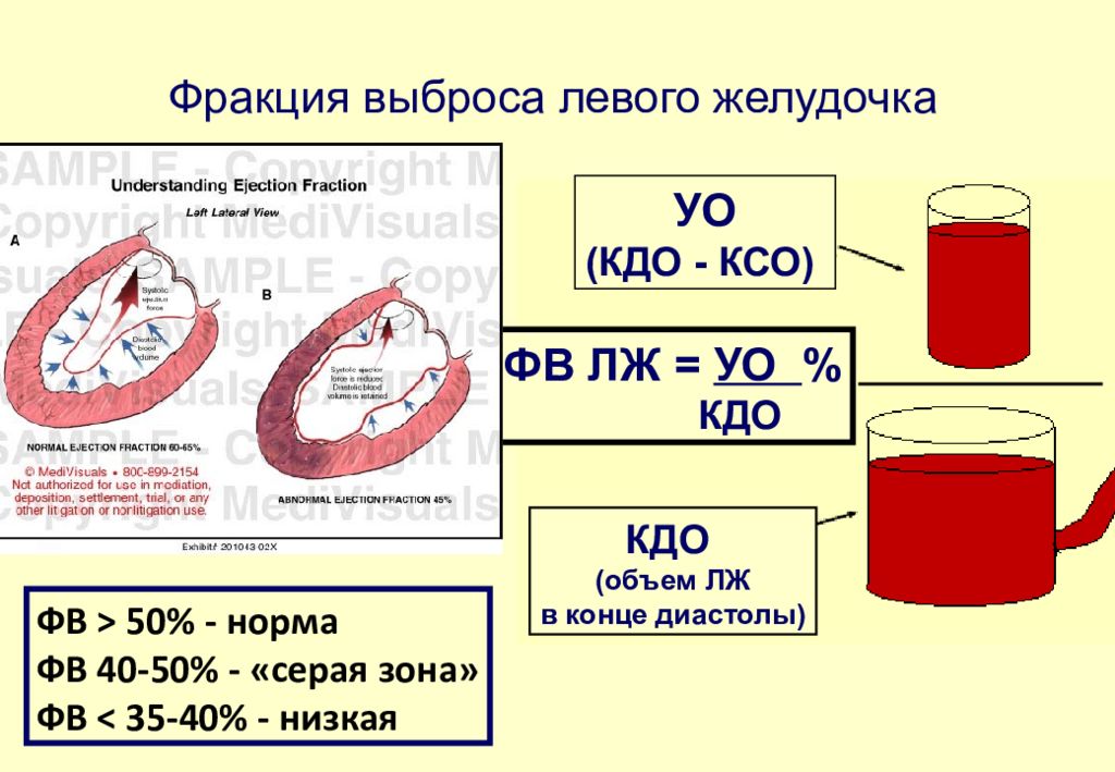 Формула эхо. Фракция выброса по тейхольцу норма. Фракция выброса сердца таблица. Фракция выброса лж 40%. Оценка фракции выброса левого желудочка.