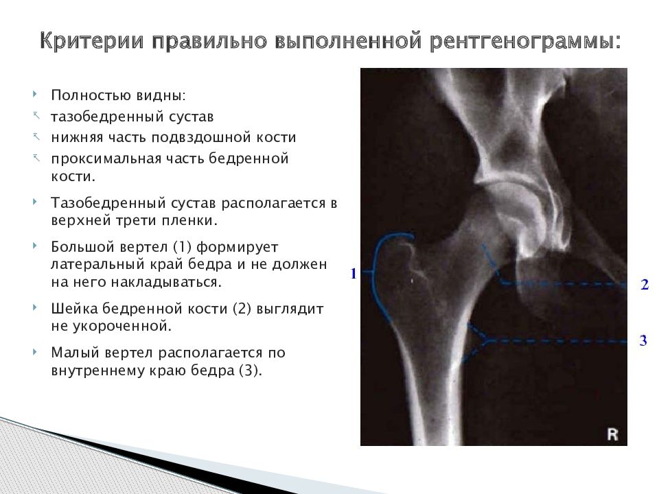 Схема описания рентгенограммы костей