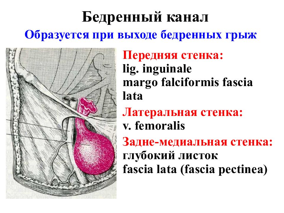 Бедренные грыжи топографическая анатомия презентация