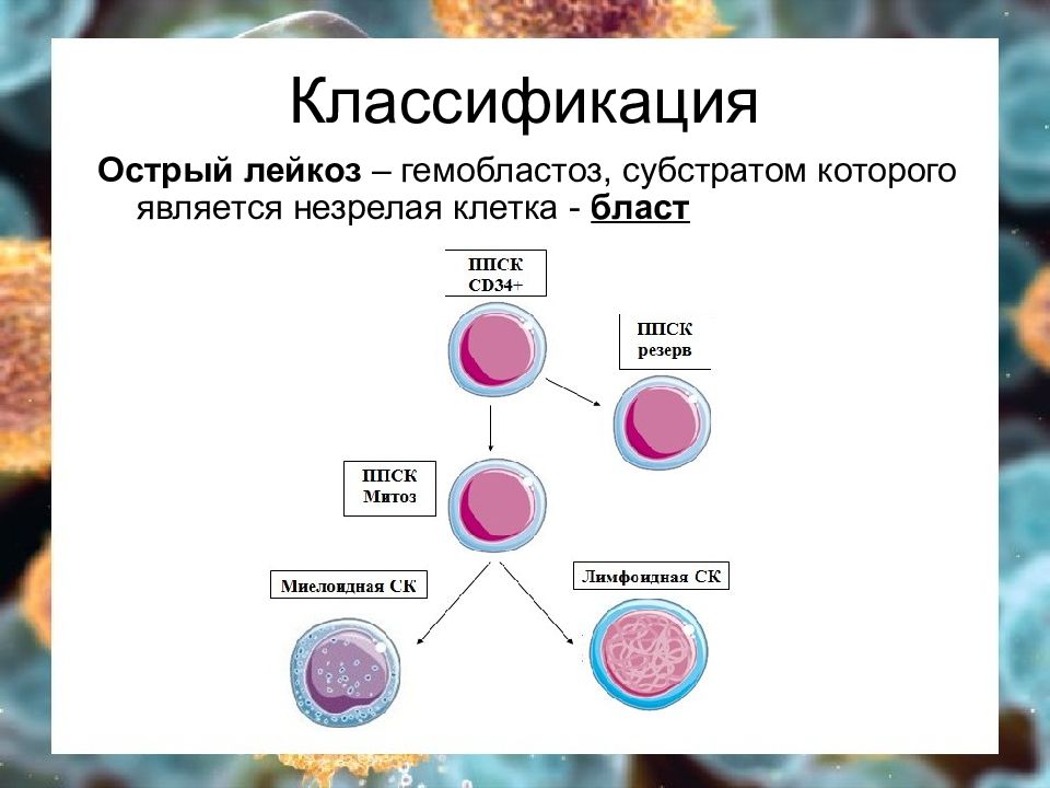 Типы острых лейкозов. Классификация острых лейкозов. Лейкоз классификация лейкозов. Лейкемия классификация. Острый миелоидный лейкоз классификация.