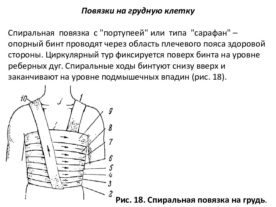 Спиральная повязка. Наложить спиральную повязку на грудную клетку алгоритм. Спиральная повязка на грудную клетку показания. Перевязка спиральная на грудную клетку. Технику наложения спиральной повязки на грудную клетку.