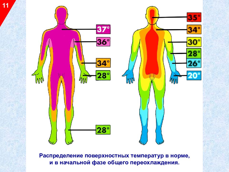 Переохлаждение организма картинки