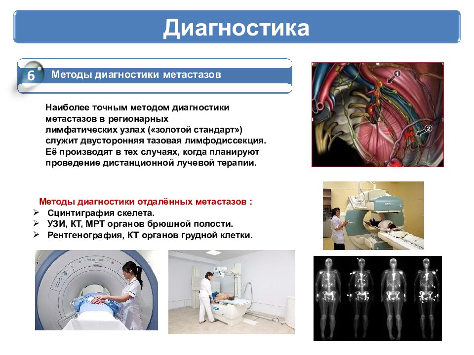 Диагностика 6. Диагностические процедуры. Методы диагностики метастазов. Методы выявления метастазов.