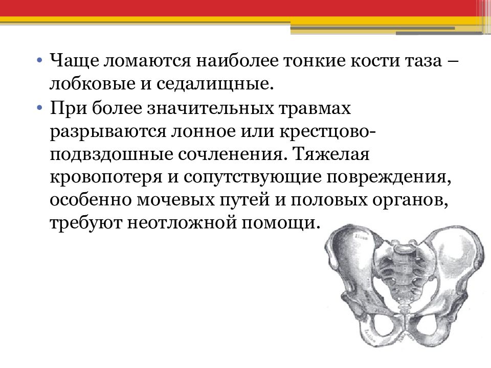 Травмы костей таза. Механизм родов при общеравномерносуженном тазе. Стреловидный шов в поперечном размере малого таза.. Трансацетабулярный перелом костей таза. Особенности биомеханизма родов при общеравномерносуженном тазе.