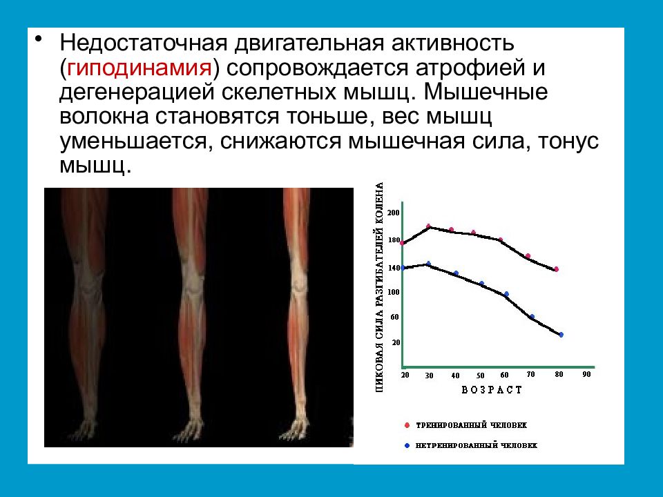 Атрофия мышц. Атрофия мышц при гиподинамии. Гиподинамия мышц. Изменение мышц при гиподинамии. Недостаточная двигательная активность.