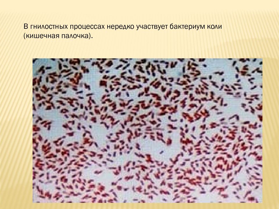 презентация: Тема: «ВИДЫ БАКТЕРИЙ»