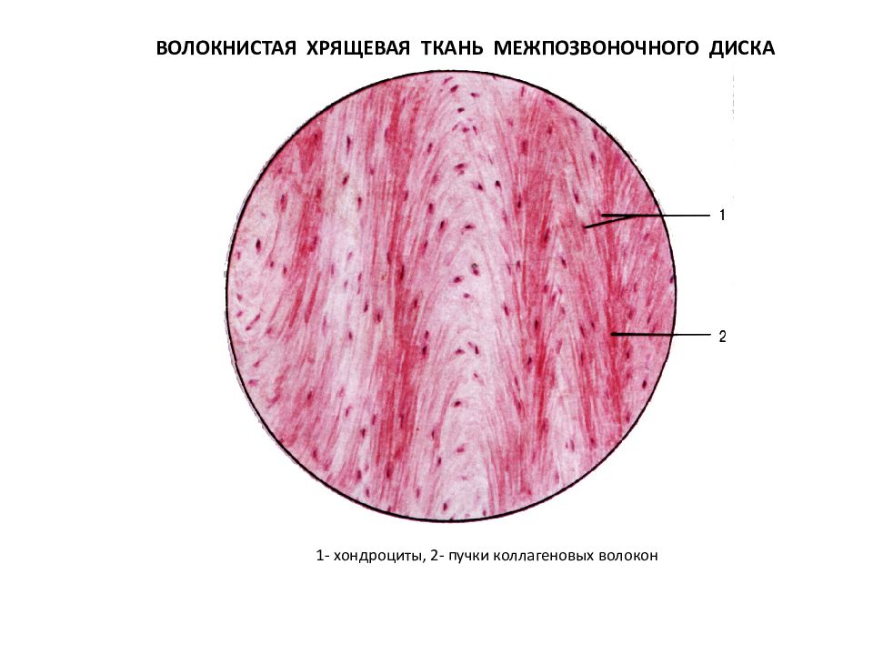 Волокнистый хрящ гистология