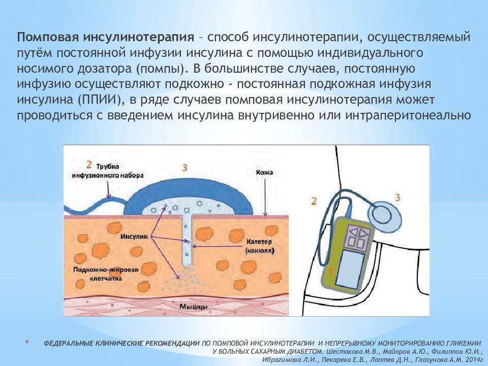 Картинка введение инсулина