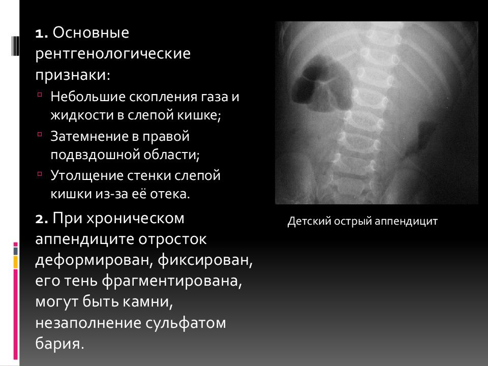 Признаки слепой кишки