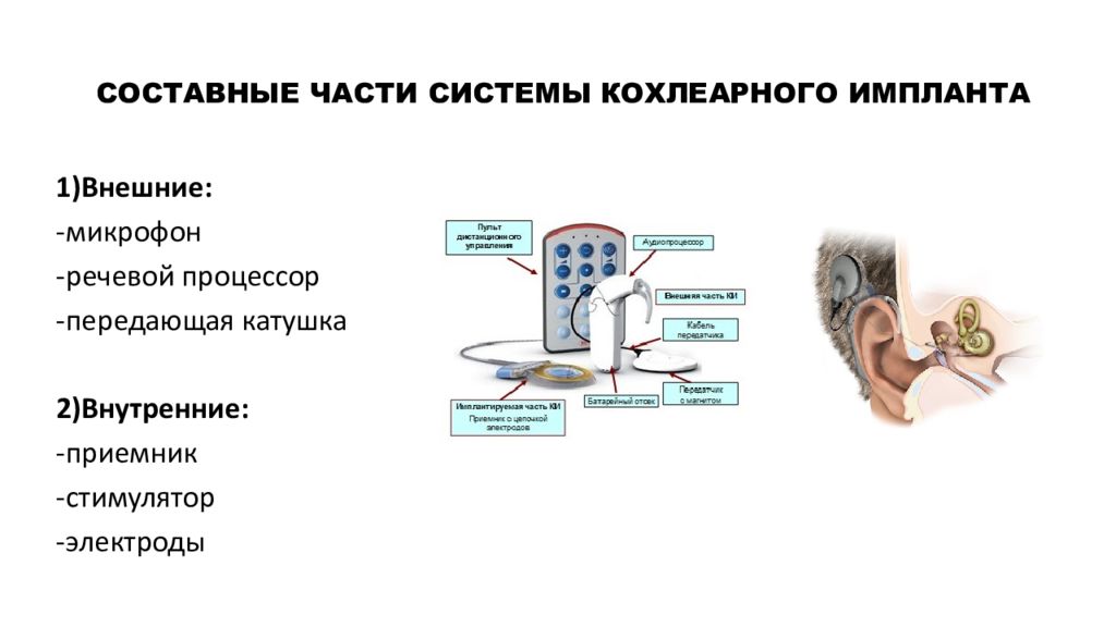 Схема работы кохлеарного импланта