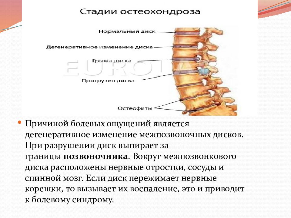 Массаж при заболеваниях опорно двигательного аппарата презентация