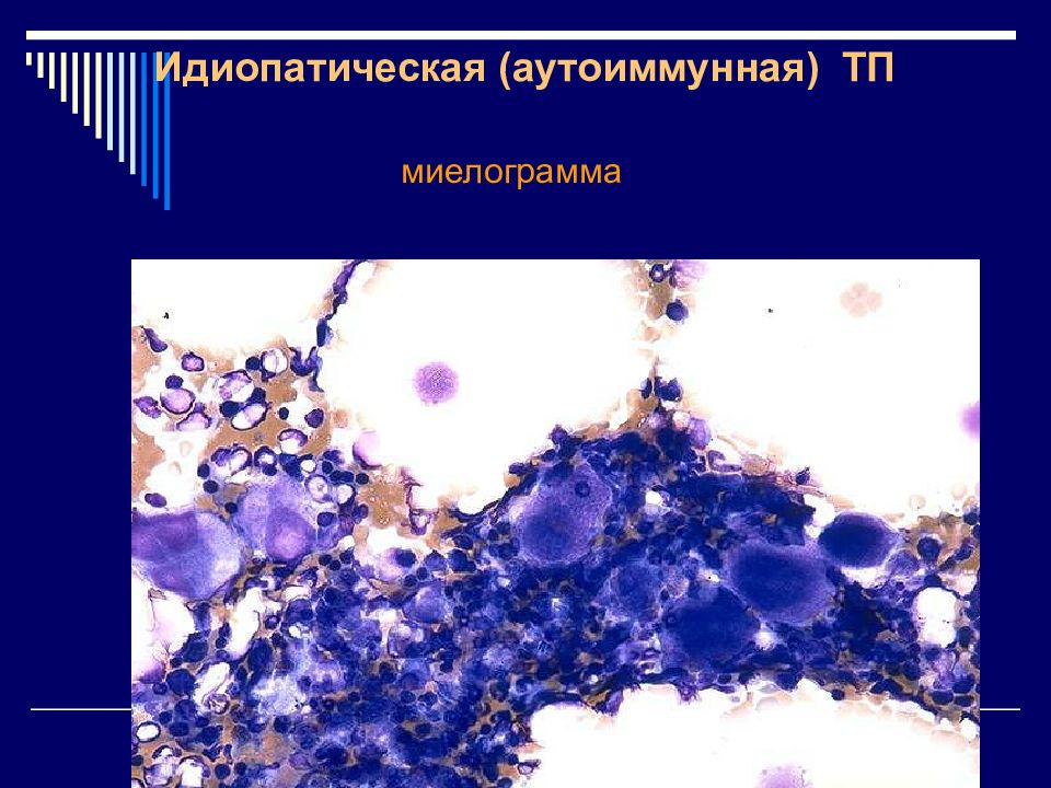 Геморрагические диатезы презентация