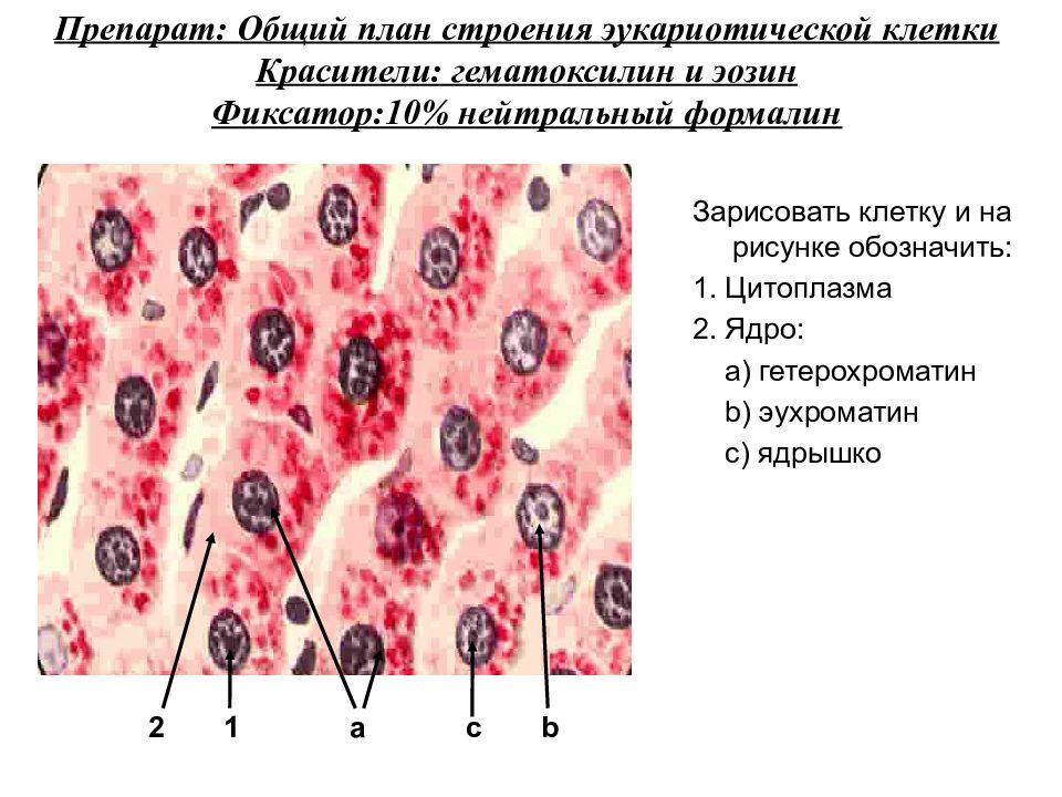 Строение препарата. Цитологический препарат строение. Гранулы красителя в цитоплазме клетки. Поврежденные и неповрежденные клетки. Ядро цитология.