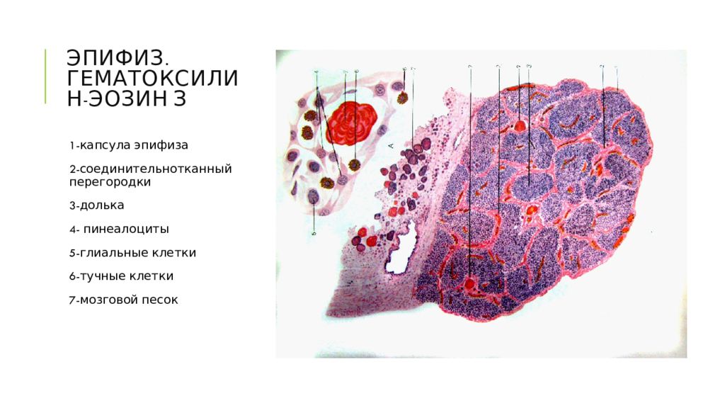 Аденогипофиз рисунок гистология