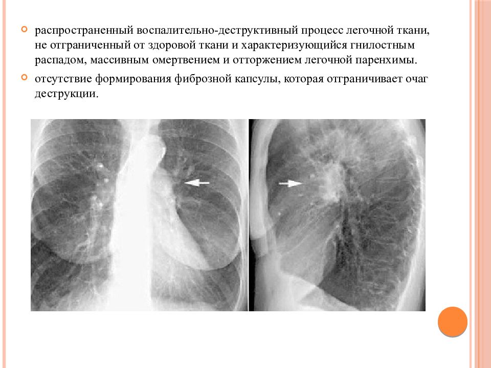 Лучевая диагностика органов дыхания презентация