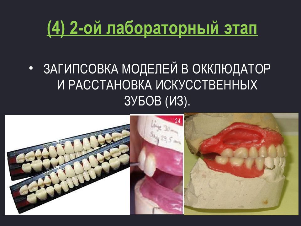 Чспп ортопедическая стоматология презентация