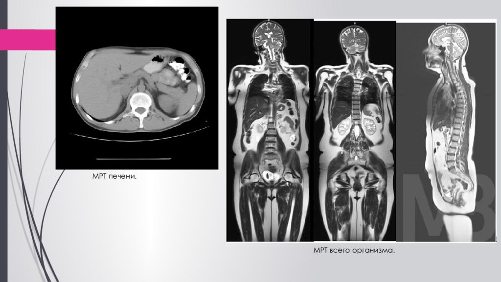 Мрт видимый. Магнитно-резонансная томография презентация. Мрт лучевая диагностика. Мрт снимки тела. Мрт метод лучевой диагностики.
