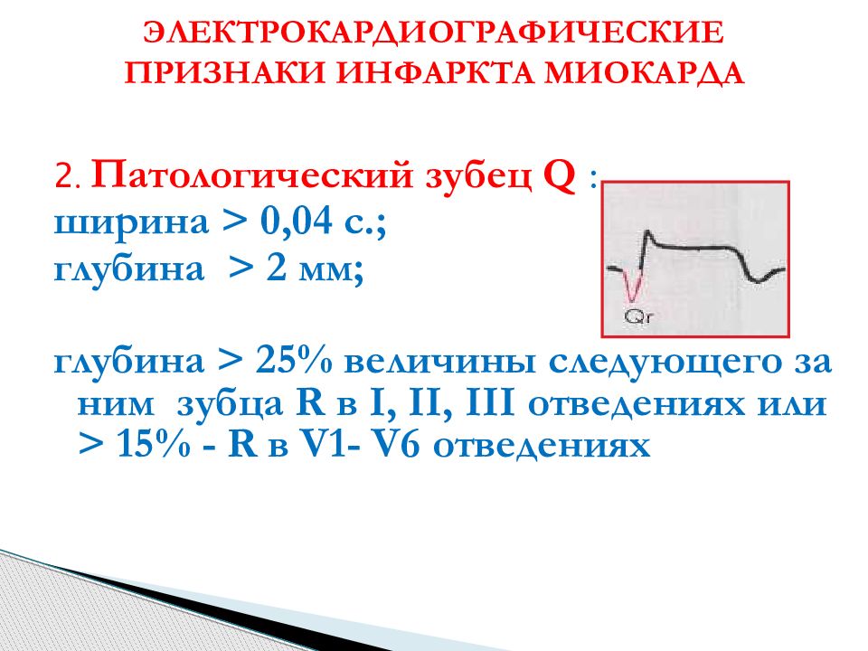 Изменение зубца q. Зубец r при инфаркте миокарда. Зубец q при инфаркте миокарда. Зубец q на ЭКГ AVL. Признаки патологического зубца q.