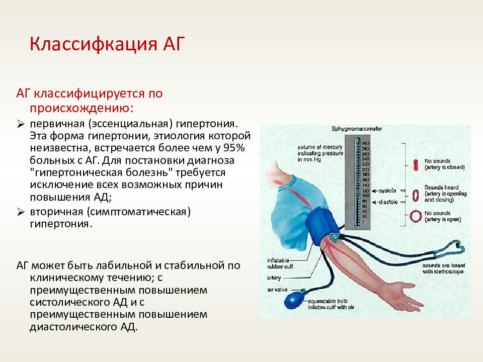 Эссенциальная гипертензия это